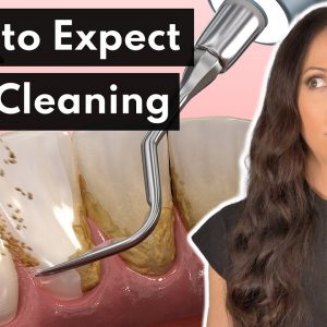 What To Expect From a DEEP Cleaning at the Dentist