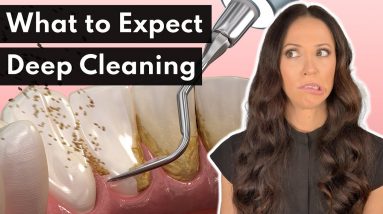 What To Expect From a DEEP Cleaning at the Dentist
