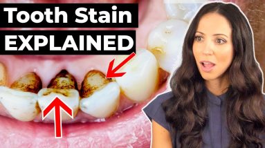 Dental Hygienist EXPLAINS Why Teeth Stain