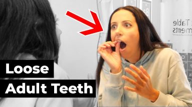 why your teeth feel LOOSE & what to DO about it