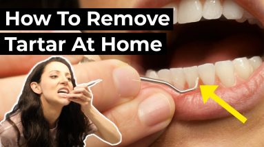 Is it Possible To Remove Tartar At Home