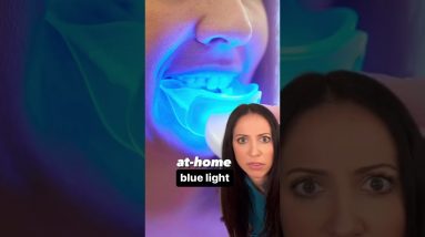 teeth whitening blue lights #shorts