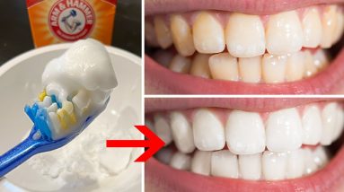 Teeth Whitening Home Remedies & DIY Hacks (Fast, Natural, & Affordable White Teeth)