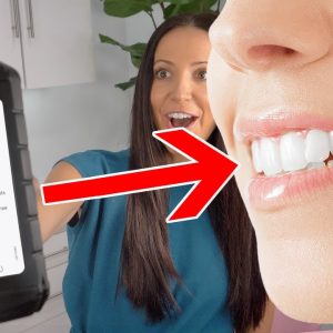 Can Hydrogen Peroxide ACTUALLY Whiten Your Teeth?