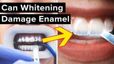 Is Teeth Whitening Destroying Your Tooth Enamel?