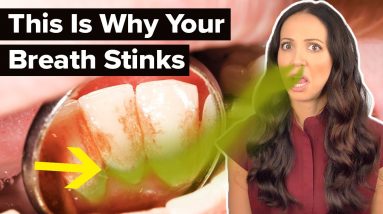 why your breath REALLY stinks (dental hygienist explains)