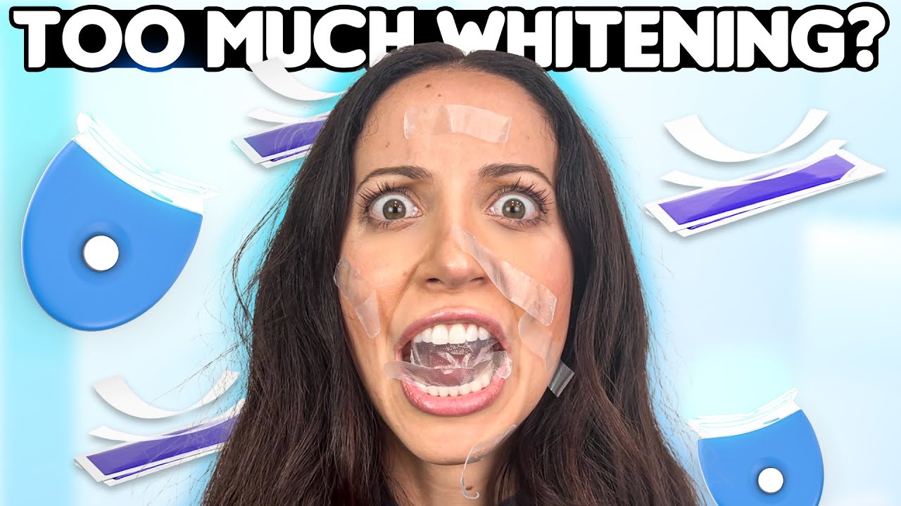 How Often Can I Whiten My Teeth? Etoners