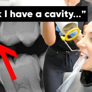 Getting Dental X-Rays & Dental Exam