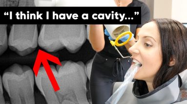 Getting Dental X-Rays & Dental Exam