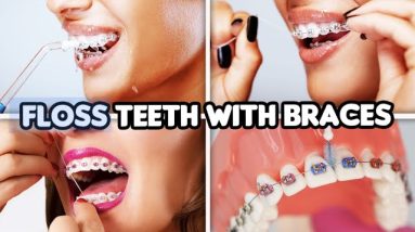 how to FLOSS your teeth WITH BRACES