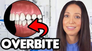 What's An Overbite?