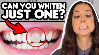 Can You Whiten One Tooth?