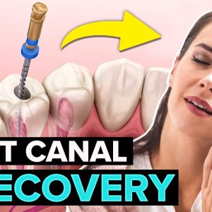 5 Root Canal Recovery Tips To Heal FAST!