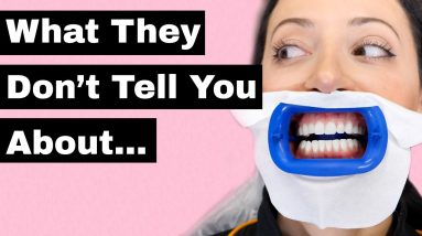 Teeth Whitening SIDE EFFECTS