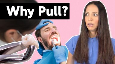 Why Do We Even Pull Teeth? (Tooth Extractions Explained)