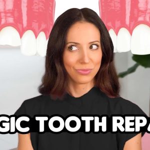 What is Tooth Bonding? (Magic?)