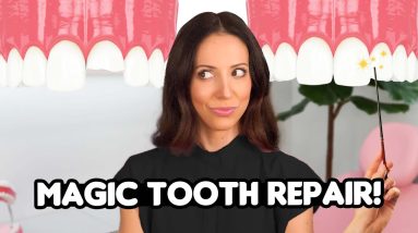 What is Tooth Bonding? (Magic?)