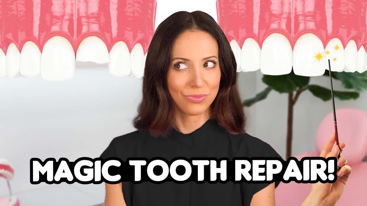What is Tooth Bonding? (Magic?) - Etoners