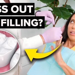 Can Your Dental Filling or Crown POP OUT During a Cleaning or Flossing?