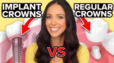 Implant Crowns vs Regular Crowns & How to Clean Them