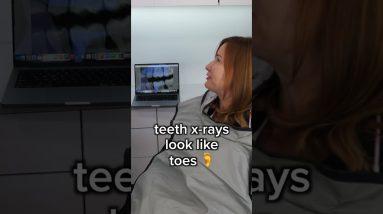 teeth x-rays look like toes #shorts