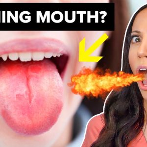 Burning Mouth Syndrome (Treatment & Remedies)