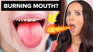 Burning Mouth Syndrome (Treatment & Remedies)
