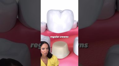 dental crowns vs implant crowns #shorts