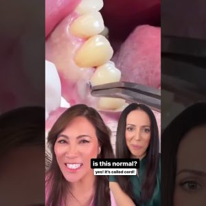 cord packing dental crowns #shorts remix with @DrPimplePopper