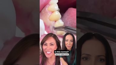 cord packing dental crowns #shorts remix with @DrPimplePopper