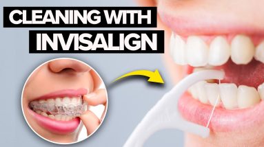 How To Care For Your Teeth During Invisalign