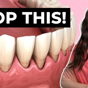 6 Ways You're Causing Gum Recession Right Now!
