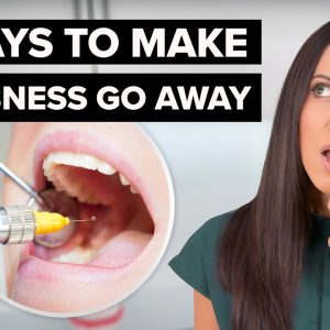 How Long Does Dental Novocaine Last? (6 Ways To Make Numbness Go Away)