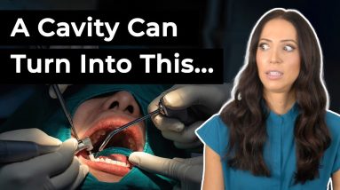 CAVITIES can turn into ROOT CANALS!