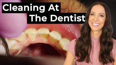 How Teeth Are Cleaned At The Dentist