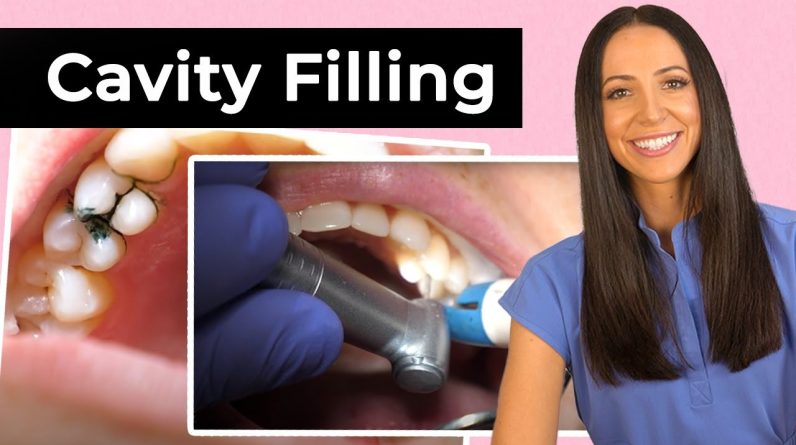 Dentist Filling a Cavity Between Teeth