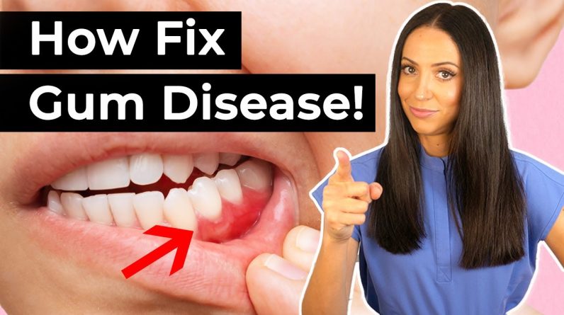 If You Have Gum Disease... Do This!