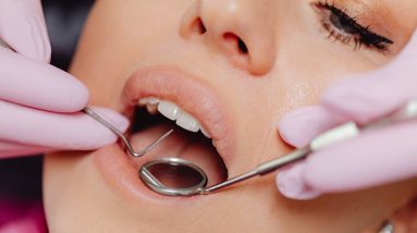 close up photo of a woman getting a dental check up