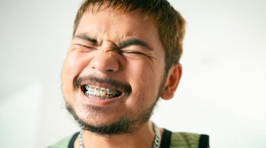 man with braces on teeth